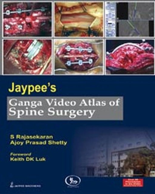 Jaypees Ganga Video Atlas of Spine Surgery