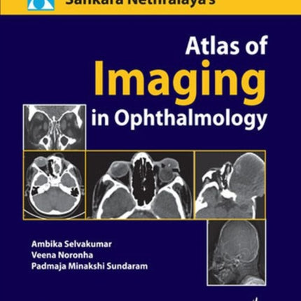 Atlas of Imaging in Ophthalmology