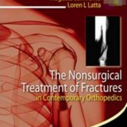 The Nonsurgical Treatment of Fractures in Contemporary Orthopedics