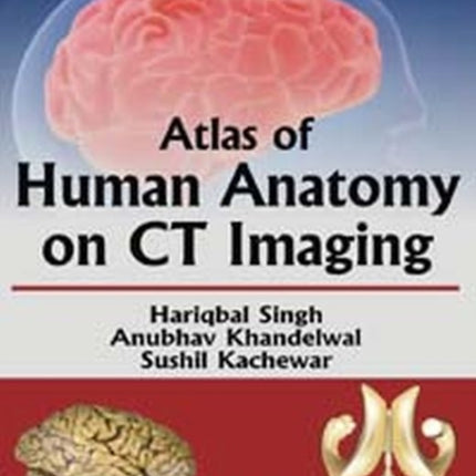 Atlas of Human Anatomy on CT Imaging