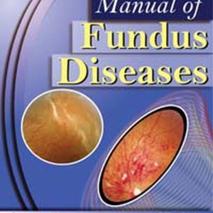 Manual of Fundus Diseases