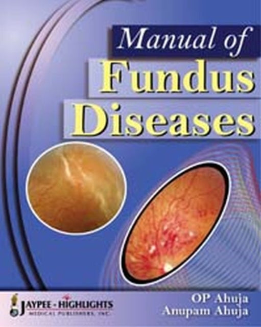 Manual of Fundus Diseases