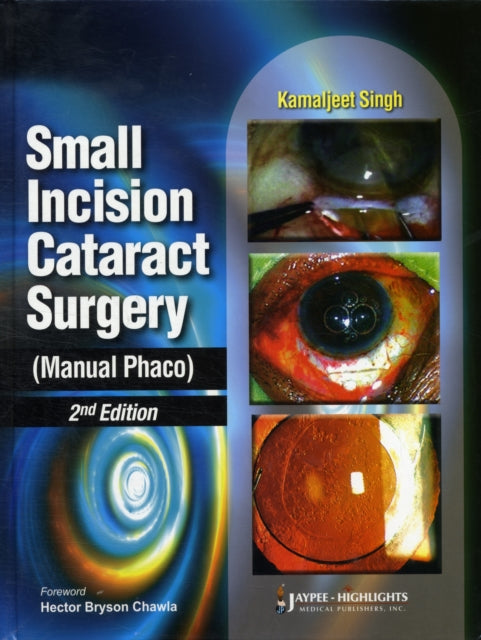 Small Incision Cataract Surgery (Manual Phaco)