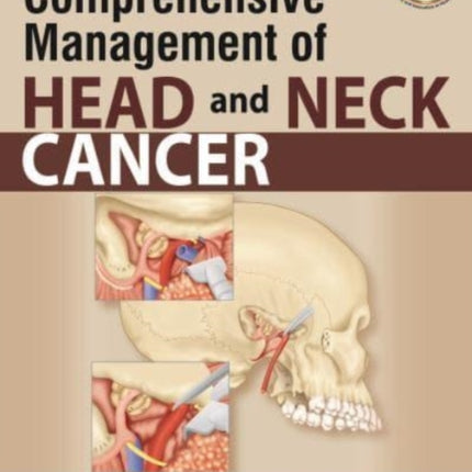 Comprehensive Management of Head and Neck Cancer