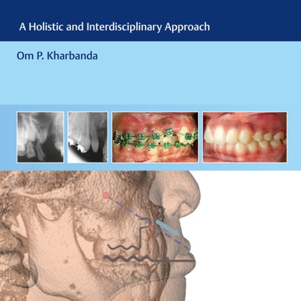 Cleft Orthodontics: A Holistic and Interdisciplinary Approach