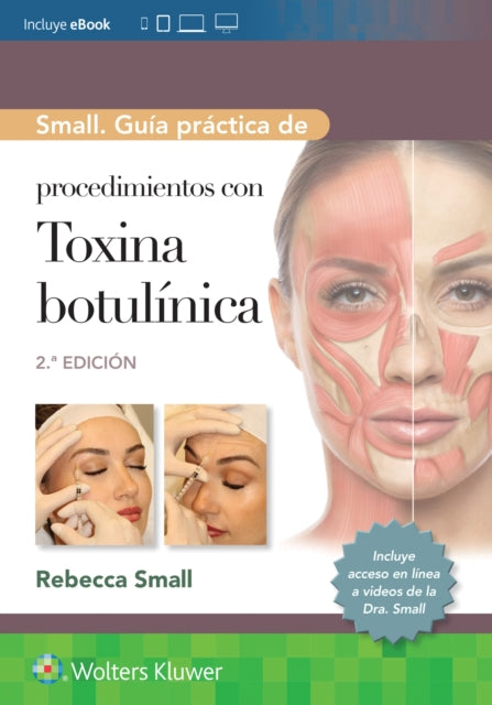 Small. Gu237a pr225ctica de procedimientos con toxina botul237nica