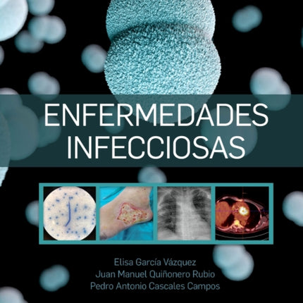 Enfermedades infecciosas