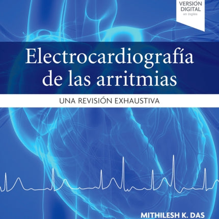Electrocardiografía de las arritmias Una revisión