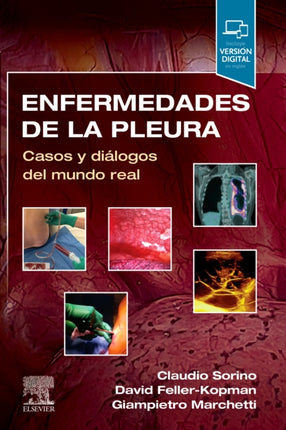 Enfermedades de la pleura Casos y diálogos del