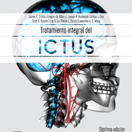 Tratamiento integral del ictus