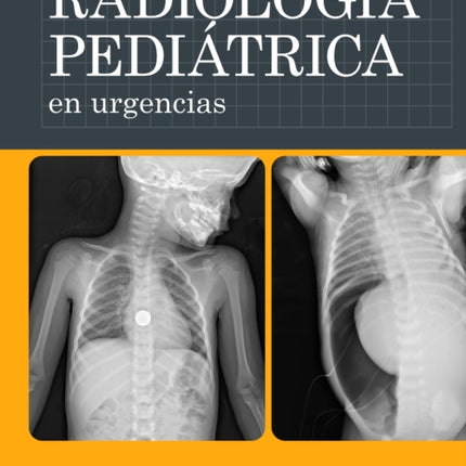 RADIOLOGIA PEDIATRICA EN URGENCIAS