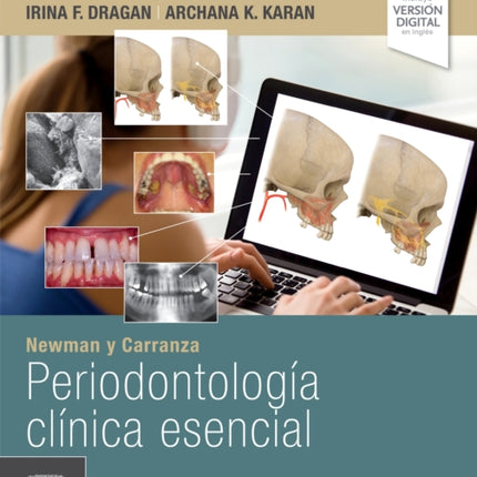 Newman y Carranza. Periodontología clínica esencial