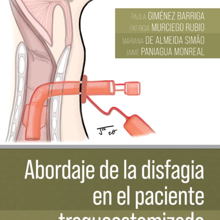 Abordaje de la disfagia en el paciente