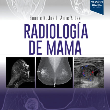 RADIOLOGIA DE MAMA 4 ED