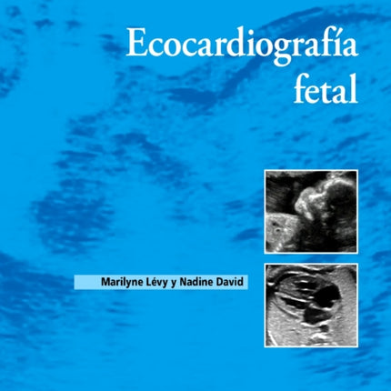 Ecocardiografia fetal
