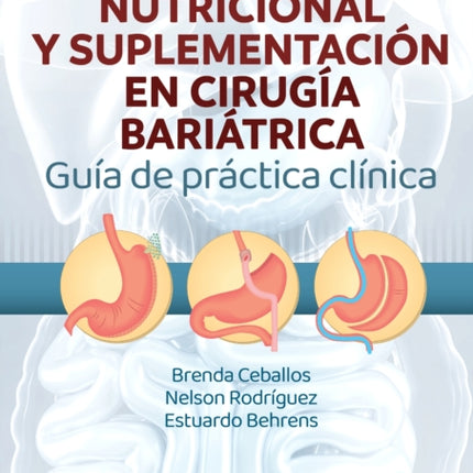 Manejo Nutricional y Suplementación en Cirugía