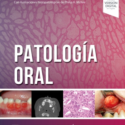 Patología oral