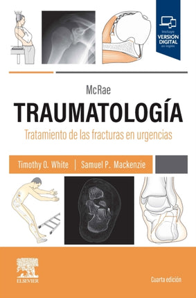 Traumatología. Tratamiento De Las Fracturas En Urgencias