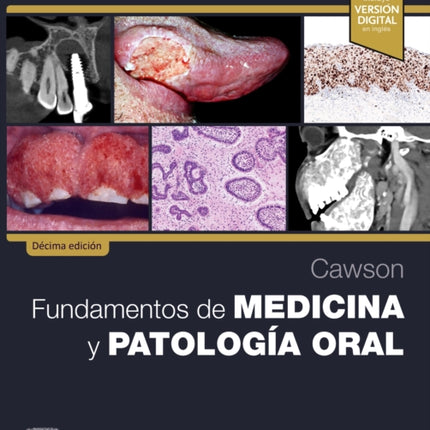 CAWSON FUNDAMENTOS DE MEDICINA Y PATOLOGIA ORAL