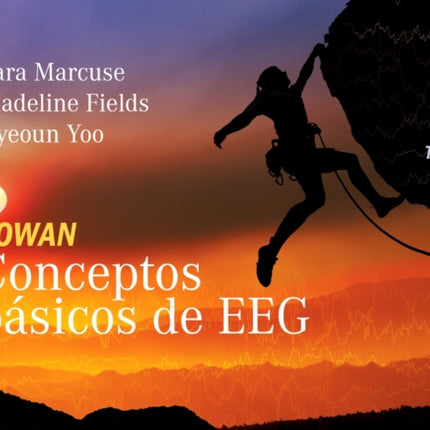 ROWAN.CONCEPTOS BASICOS DE EEG