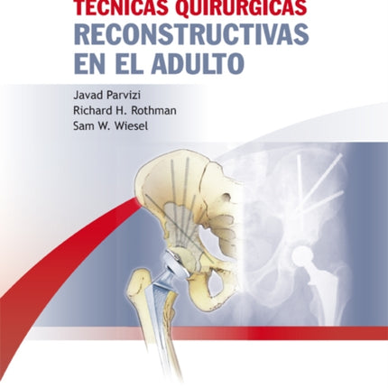 Técnicas quirúrgicas reconstructivas en el adulto