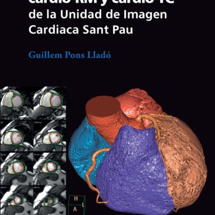 Protocolos de cardio-RM y cardio-TC de la Unidad de Imagen Cardiaca Sant Pau