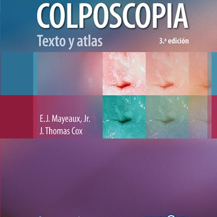 Colposcopia. Texto y atlas