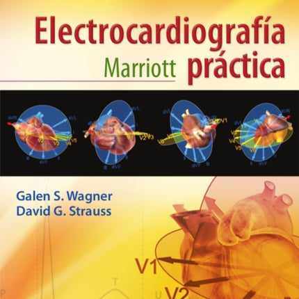 Marriott. Electrocardiografía práctica