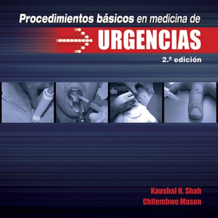 Procedimientos básicos en medicina de urgencias