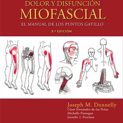 Travell, Simons & Simons. Dolor y disfunción miofascial: El manual de los puntos gatillo