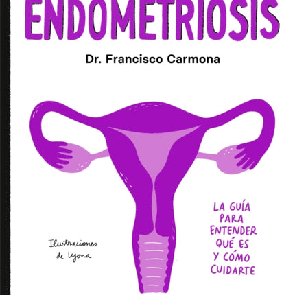 Endometriosis: La guía para entender qué es y cómo cuidarte / Endometriosis: The   Guide to Understanding What It Is and How to Take Care of Yourself