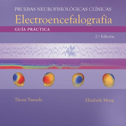 Pruebas neurofisiológicas clínicas. Electroencefalografía: Guía práctica