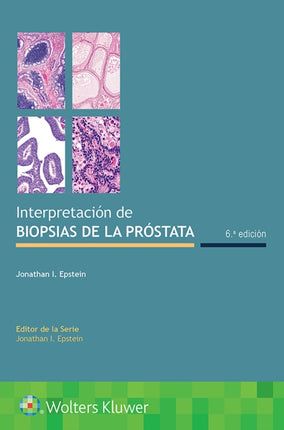 Interpretación de biopsias de la próstata