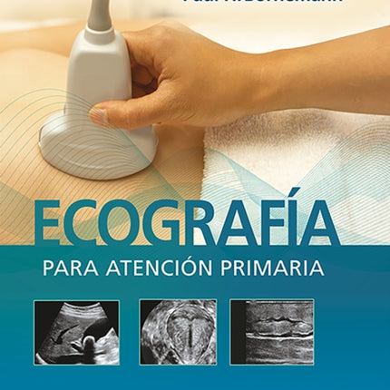 Ecografía para atención primaria