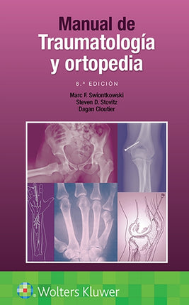 Manual de traumatología y ortopedia