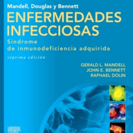 Mandell Douglas y Bennett Enfermedades infecciosas Sindrome de inmunodeficiencia adquirida Spanish Edition