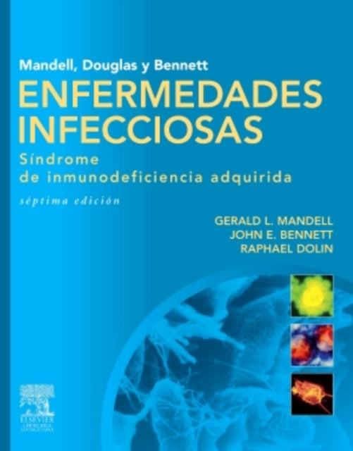 Mandell Douglas y Bennett Enfermedades infecciosas Sindrome de inmunodeficiencia adquirida Spanish Edition