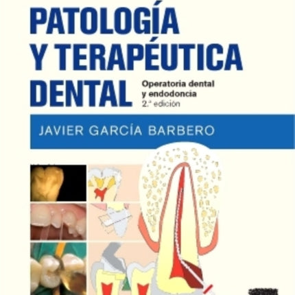 Patología y terapéutica dental. 2 Edición