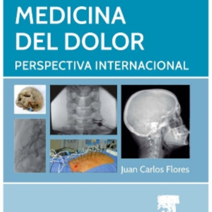 Medicina del dolor Perspectiva Internacional