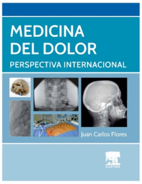 Medicina del dolor Perspectiva Internacional