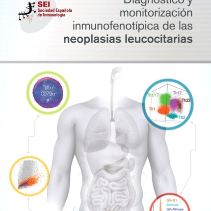 Diagnóstico y monitorización inmunofenotípica de
