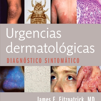 Fitzpatrick J Urgencias dermatológicas
