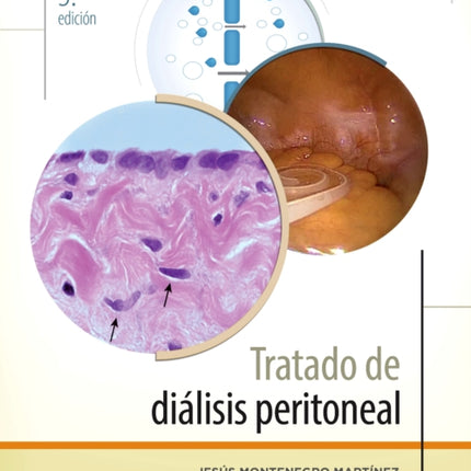 Tratado de dilisis peritoneal 3 ed