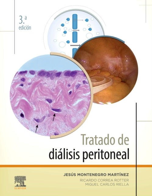 Tratado de dilisis peritoneal 3 ed