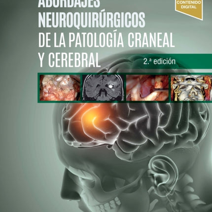 Abordajes Neuroquirrgicos De La Patologa Craneal
