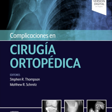Complicaciones en cirugía ortopédica Medicina
