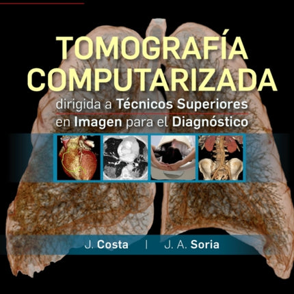 Tomografía computarizada dirigida a técnicos