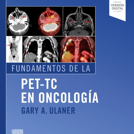 Fundamentos de la PETTC en oncologa