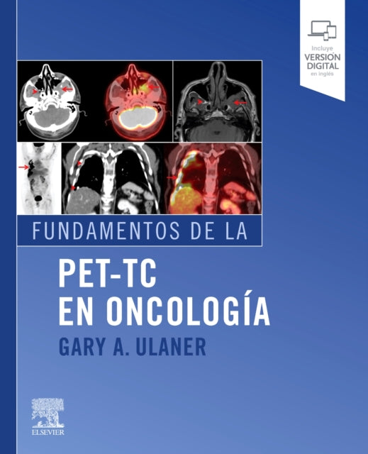 Fundamentos de la PETTC en oncologa