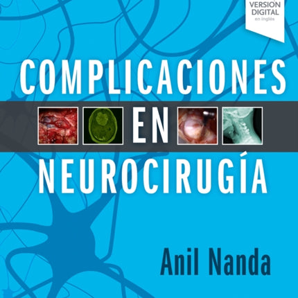 Complicaciones En Neurociruga